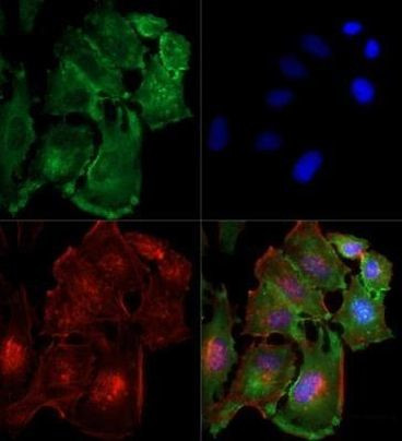 TBK1 Antibody in Immunocytochemistry (ICC/IF)