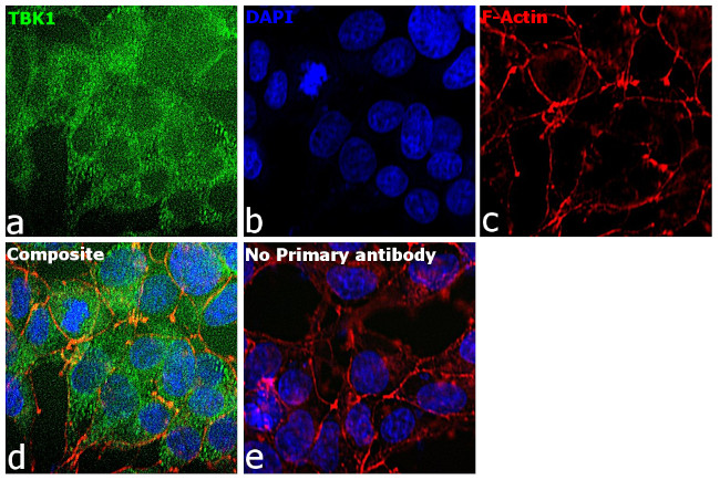 TBK1 Antibody in Immunocytochemistry (ICC/IF)