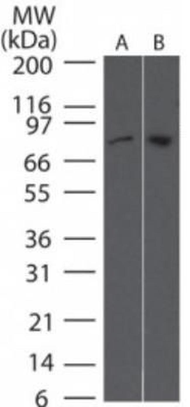 TBK1 Antibody in Western Blot (WB)