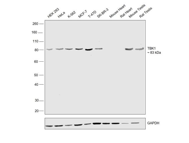 TBK1 Antibody in Western Blot (WB)