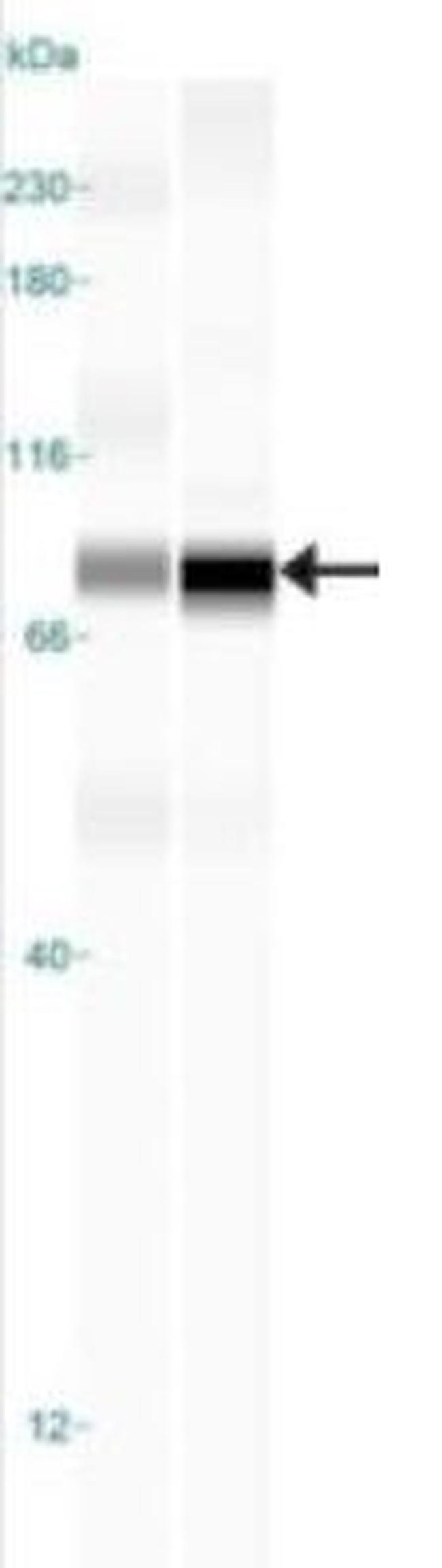 TBK1 Antibody in Western Blot (WB)