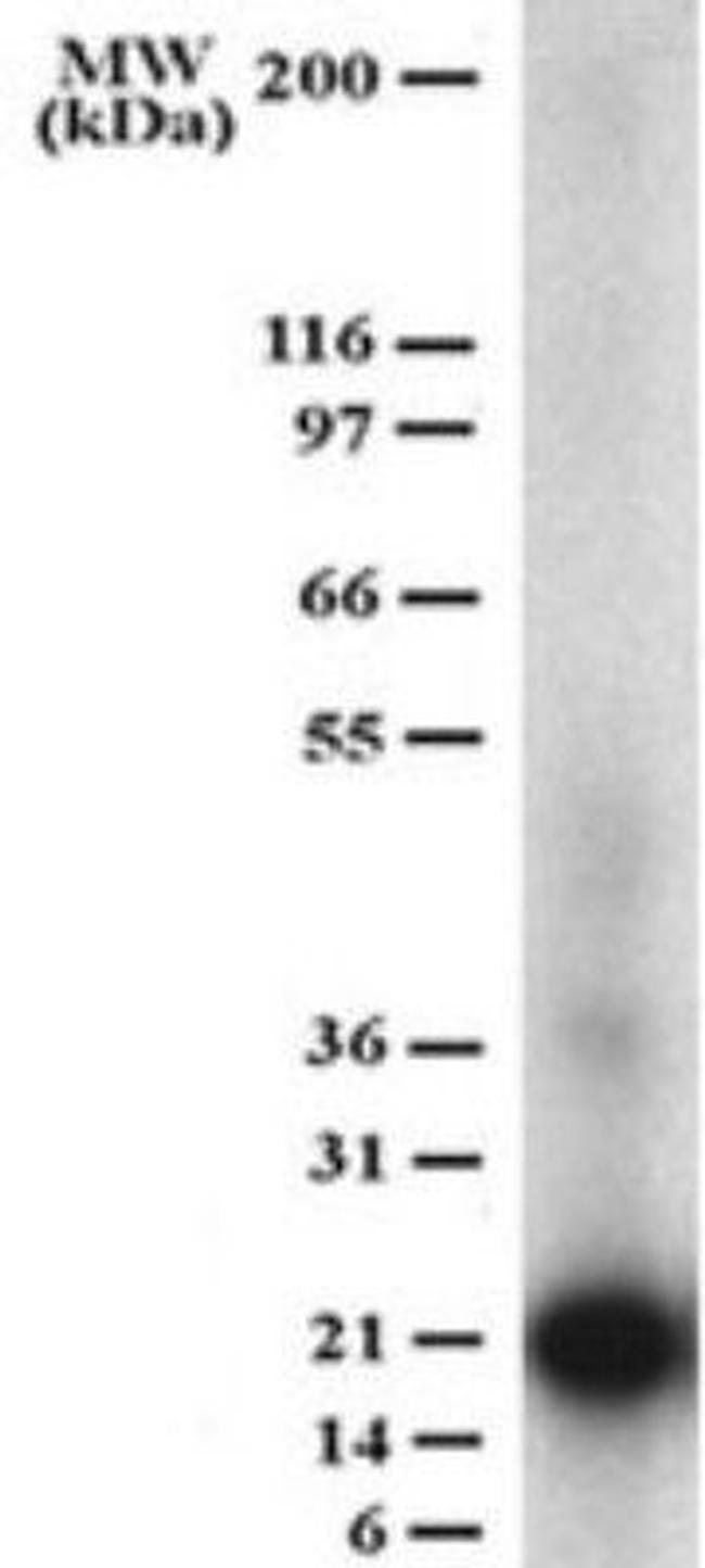 CD254 (RANK Ligand) Antibody in Western Blot (WB)