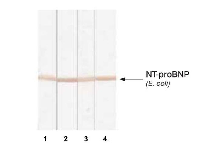 pro-Brain Natriuretic Peptide Antibody in Western Blot (WB)