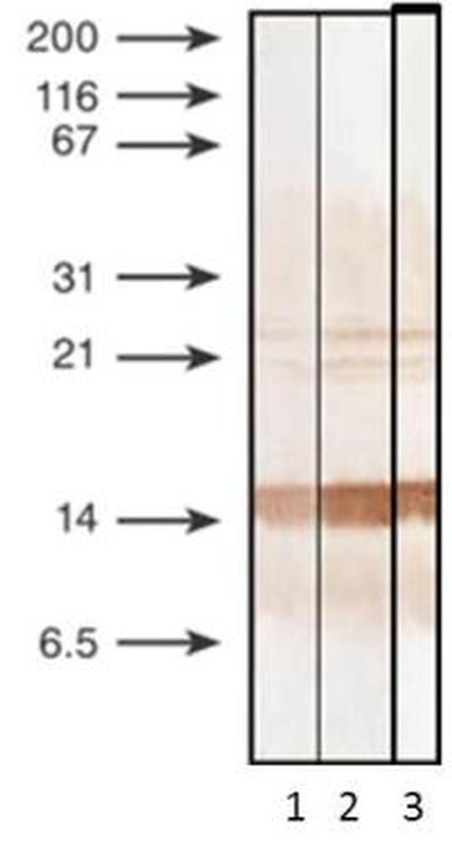 Procalcitonin Antibody in Western Blot (WB)