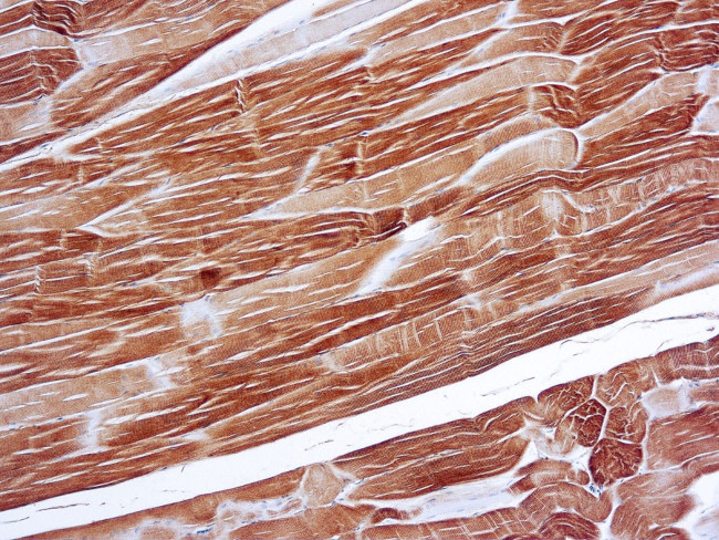 Sarcomeric alpha Actin Antibody in Immunohistochemistry (Paraffin) (IHC (P))