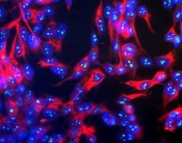 Fibrillarin Antibody in Immunocytochemistry (ICC/IF)