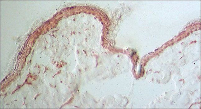 Collagen III Antibody in Immunohistochemistry (Frozen) (IHC (F))