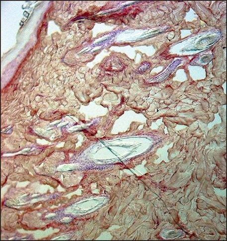 Collagen III Antibody in Immunohistochemistry (Paraffin) (IHC (P))