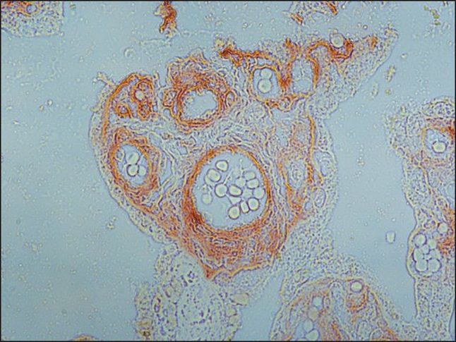 Collagen IV Antibody in Immunohistochemistry (Paraffin) (IHC (P))