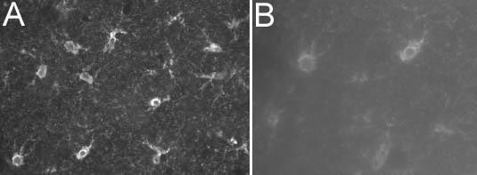 S100 Antibody in Immunohistochemistry - Free Floating (IHC (Free))