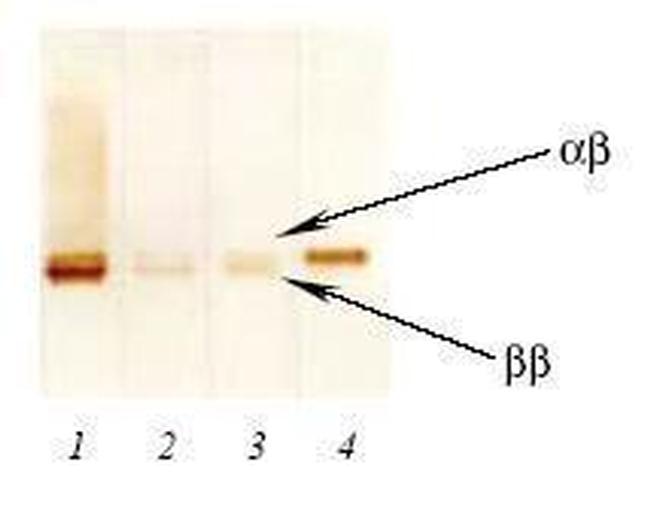 S100 Antibody in Western Blot (WB)