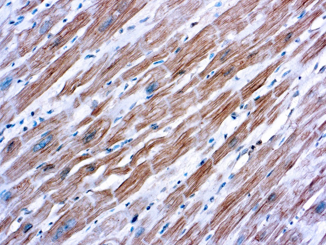 Sarcomeric alpha Actinin Antibody in Immunohistochemistry (Paraffin) (IHC (P))