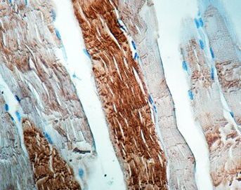 Sarcomeric alpha Actinin Antibody in Immunohistochemistry (Paraffin) (IHC (P))