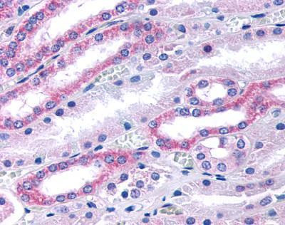 GUCY1B2 (soluble) Antibody in Immunohistochemistry (IHC)