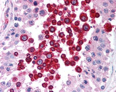 ATM Antibody in Immunohistochemistry (Paraffin) (IHC (P))