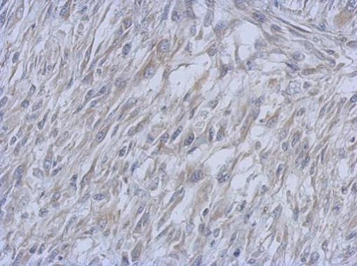 ATM Antibody in Immunohistochemistry (Paraffin) (IHC (P))