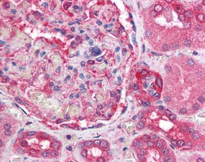 ATM Antibody in Immunohistochemistry (Paraffin) (IHC (P))