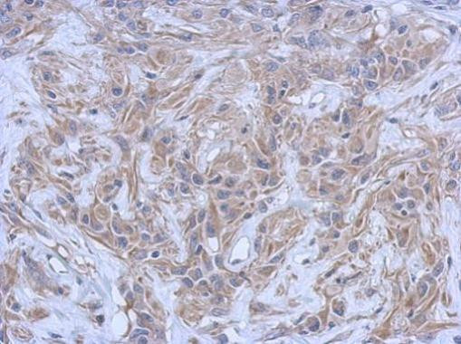 ATM Antibody in Immunohistochemistry (Paraffin) (IHC (P))