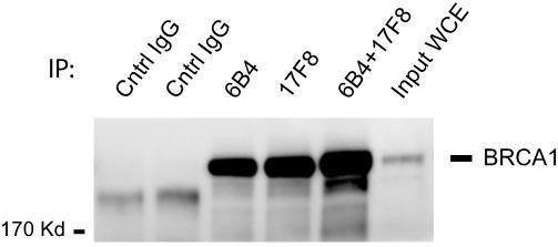 BRCA1 Antibody in Immunoprecipitation (IP)