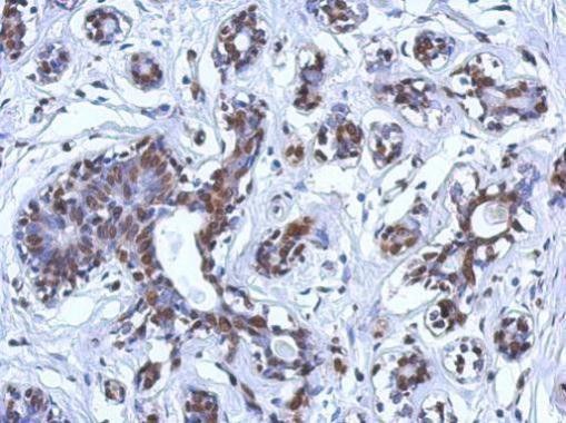 BRCA1 Antibody in Immunohistochemistry (Paraffin) (IHC (P))