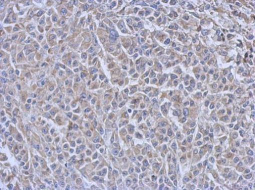 Cdc34 Antibody in Immunohistochemistry (Paraffin) (IHC (P))