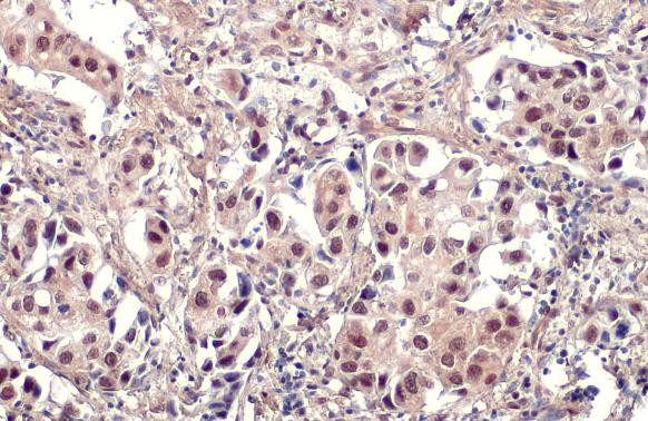 E2F1 Antibody in Immunohistochemistry (Paraffin) (IHC (P))