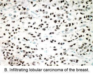 Estrogen Receptor beta Antibody in Immunohistochemistry (IHC)