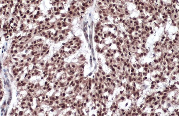 Estrogen Receptor beta Antibody in Immunohistochemistry (Paraffin) (IHC (P))