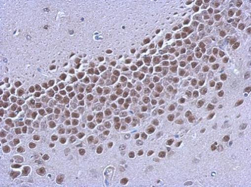 Estrogen Receptor beta Antibody in Immunohistochemistry (Paraffin) (IHC (P))