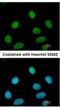 FEN1 Antibody in Immunocytochemistry (ICC/IF)