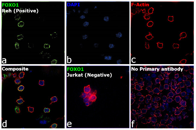 FOXO1 Antibody in Immunocytochemistry (ICC/IF)