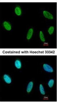 SAFB Antibody in Immunocytochemistry (ICC/IF)