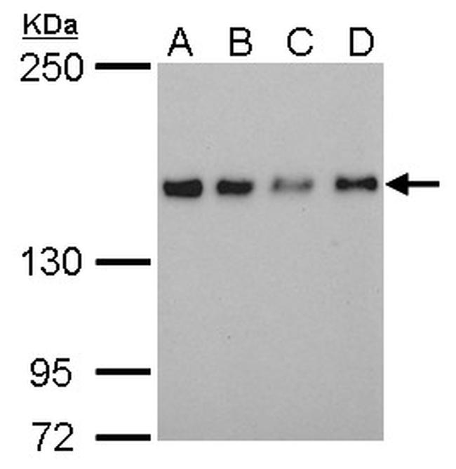 SAFB Antibody in Western Blot (WB)