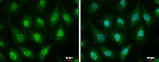 ID3 Antibody in Immunocytochemistry (ICC/IF)