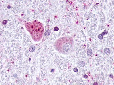 JAB1 Antibody in Immunohistochemistry (IHC)