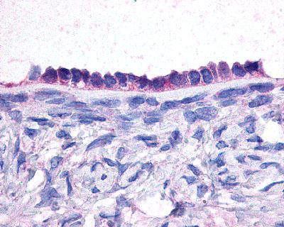 JAB1 Antibody in Immunohistochemistry (IHC)