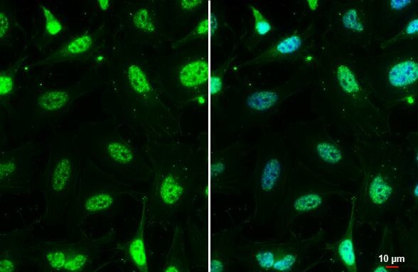 MRE11 Antibody in Immunocytochemistry (ICC/IF)