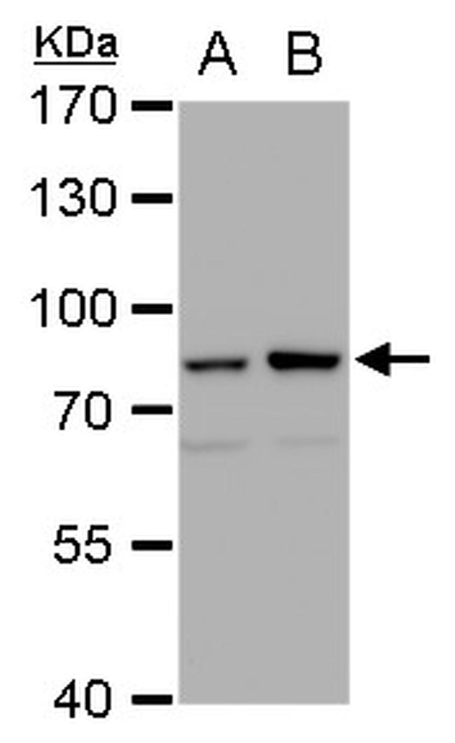 MRE11 Antibody in Western Blot (WB)