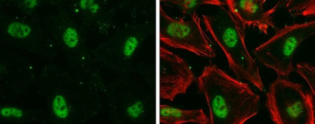 Nuclear Matrix Protein p84 Antibody in Immunocytochemistry (ICC/IF)