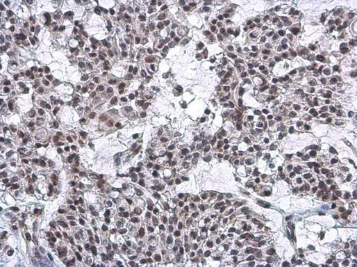 Nuclear Matrix Protein p84 Antibody in Immunohistochemistry (Paraffin) (IHC (P))