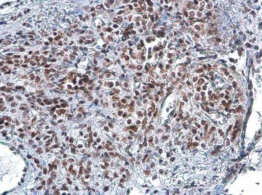 RAD50 Antibody in Immunohistochemistry (Paraffin) (IHC (P))