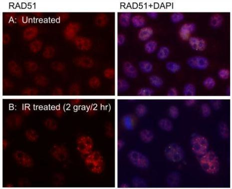 RAD51 Antibody in Immunocytochemistry (ICC/IF)