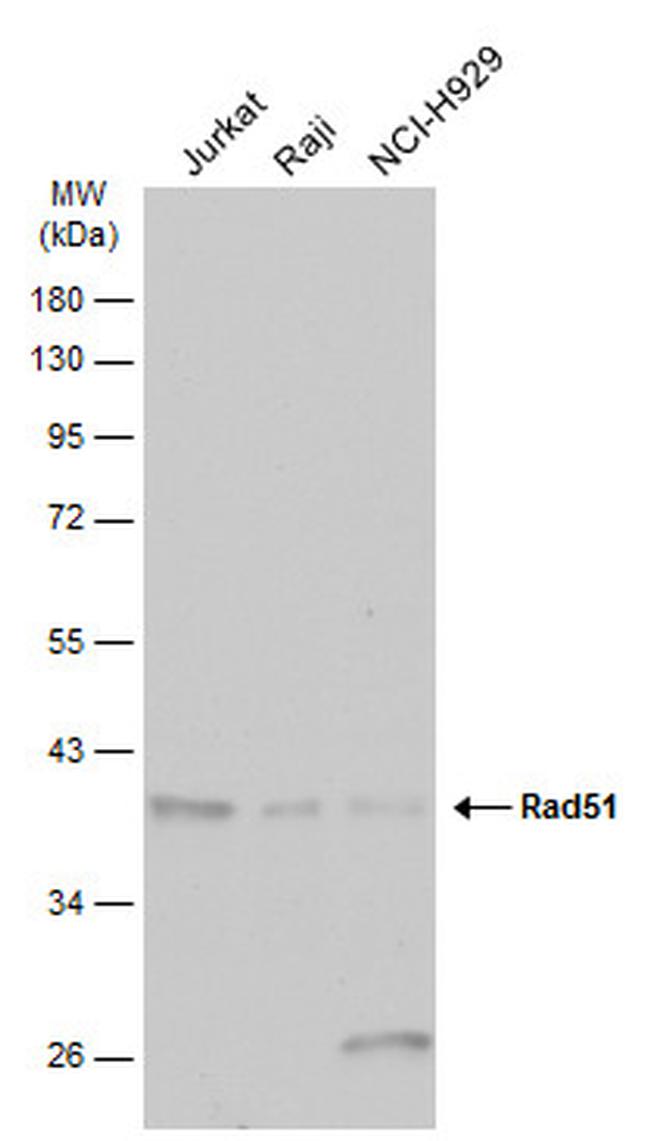 RAD51 Antibody in Western Blot (WB)