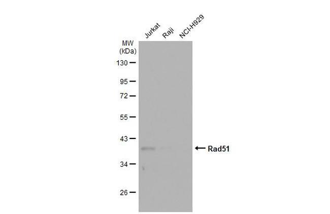 RAD51 Antibody in Western Blot (WB)