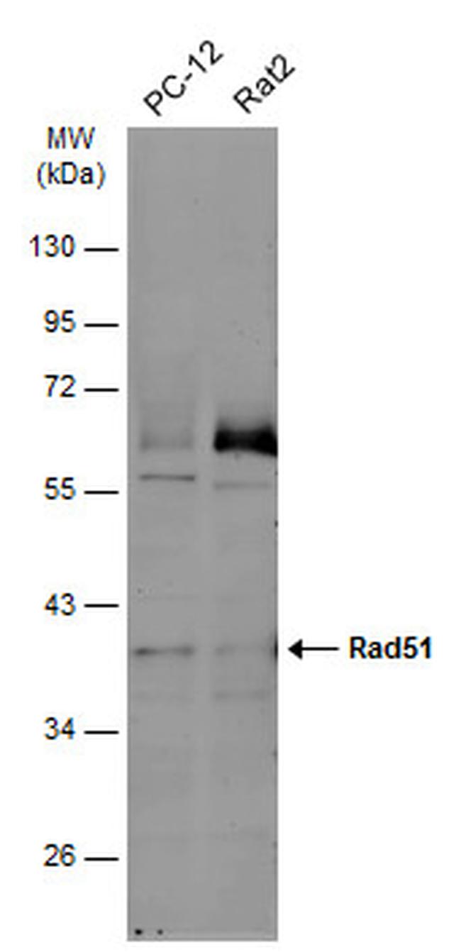 RAD51 Antibody in Western Blot (WB)