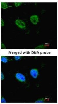 RbAp48 Antibody in Immunocytochemistry (ICC/IF)