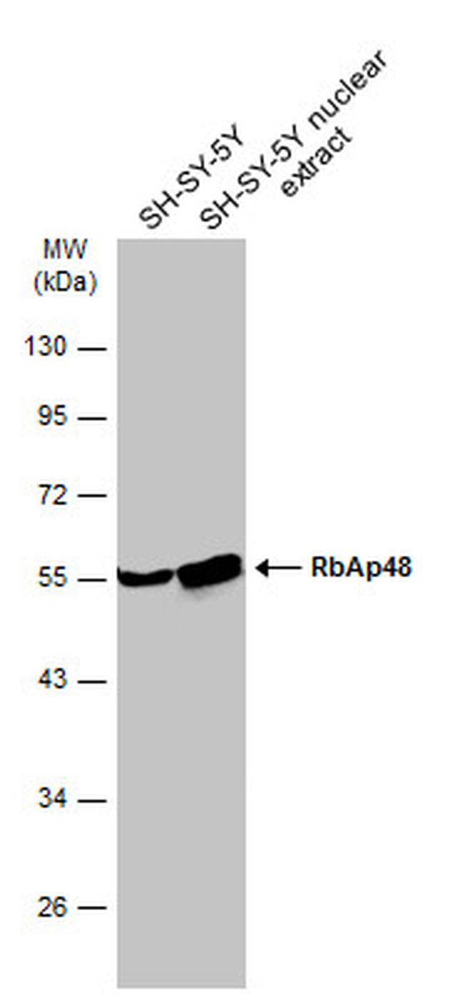 RbAp48 Antibody in Western Blot (WB)