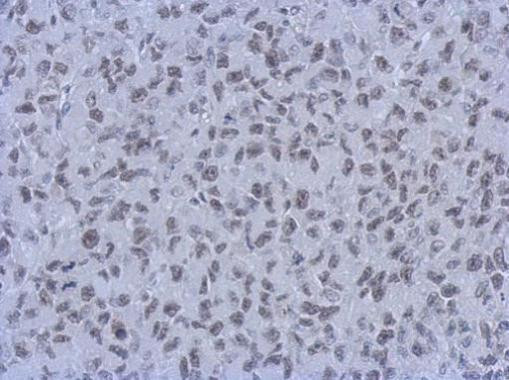 RbAp46/RbAp48 Antibody in Immunohistochemistry (Paraffin) (IHC (P))