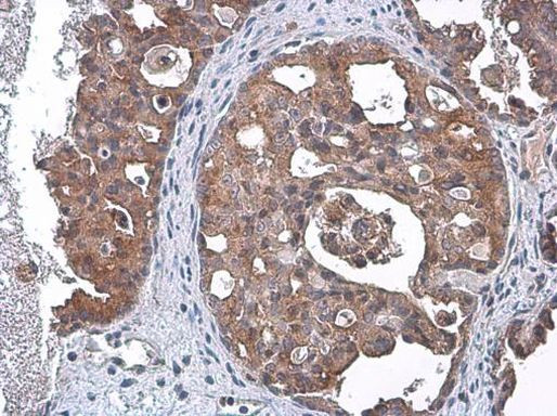 TSG101 Antibody in Immunohistochemistry (Paraffin) (IHC (P))