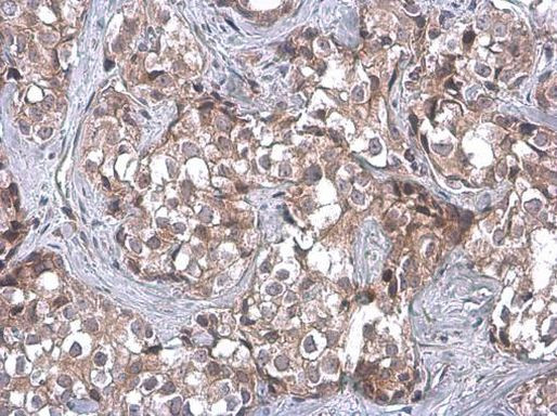 TSG101 Antibody in Immunohistochemistry (Paraffin) (IHC (P))